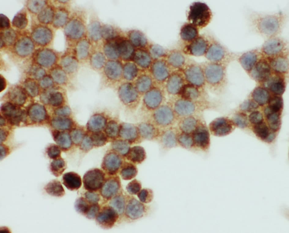 Polyclonal Rabbit anti-Human ONECUT1 / HNF6 Antibody (aa187-203, IHC, WB)