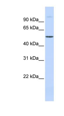 URI1 / NNX3 Antibody (aa359-408)