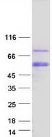 Human ESRRG / ERR Gamma Protein (Recombinant Myc-DDK (Flag))