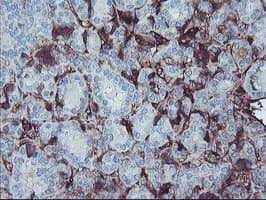 AHSG / Fetuin A Antibody (clone OTI2H2)