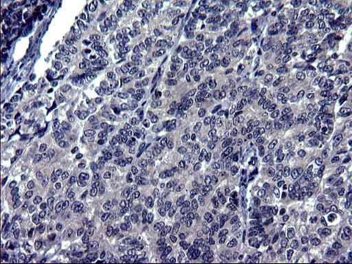 TXNDC5 / ERP46 Antibody (clone OTI1C3)