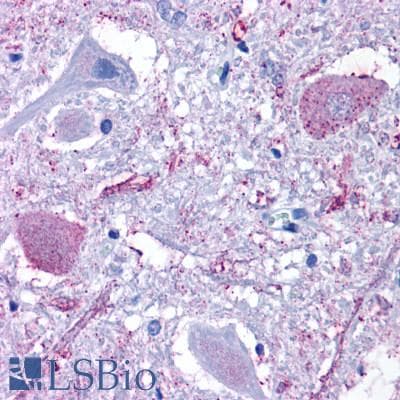 PathPlus™ Polyclonal Rabbit anti-Human GPR6 Antibody (C-Terminus, IHC)