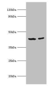 Polyclonal Rabbit anti-Human SCAD / ACADS Antibody (aa1-260, IHC, WB)
