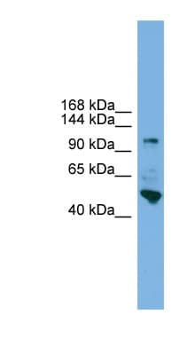 Polyclonal Rabbit anti-Human PCDH18 Antibody (N-Terminus, WB)