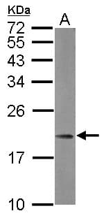Polyclonal Rabbit anti-Human MRPL21 Antibody (WB)