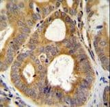 Polyclonal Rabbit anti-Human TRPM8 Antibody (aa69-98, IHC, WB)