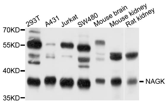 NAGK Antibody