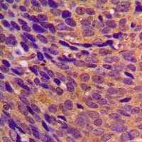 CBR3 Antibody (Internal)