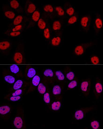 DNMT / DNMT1 Antibody