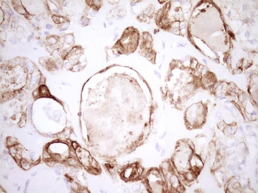 Monoclonal Mouse anti-Human KRT19 / CK19 / Cytokeratin 19 Antibody (clone OTI6A8, aa240-390, IHC, WB)