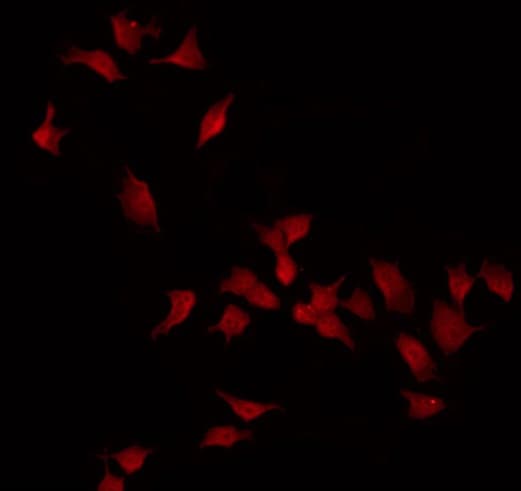 Polyclonal Rabbit anti-Human INSL4 Antibody (IF, WB)