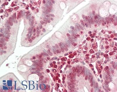 IHC-plus™ NBN / Nibrin Antibody