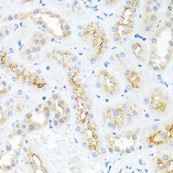 Polyclonal Rabbit anti-Human IL8 / Interleukin 8 Antibody (IHC)