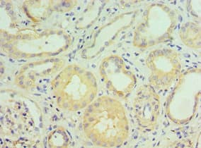 GGA2 Antibody (aa1-300)