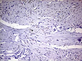PR / Progesterone Receptor Antibody (aa1-298, clone OTI5C12)