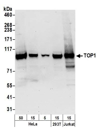 IHC-plus™ TOP1 / Topoisomerase I Antibody (aa715-765)