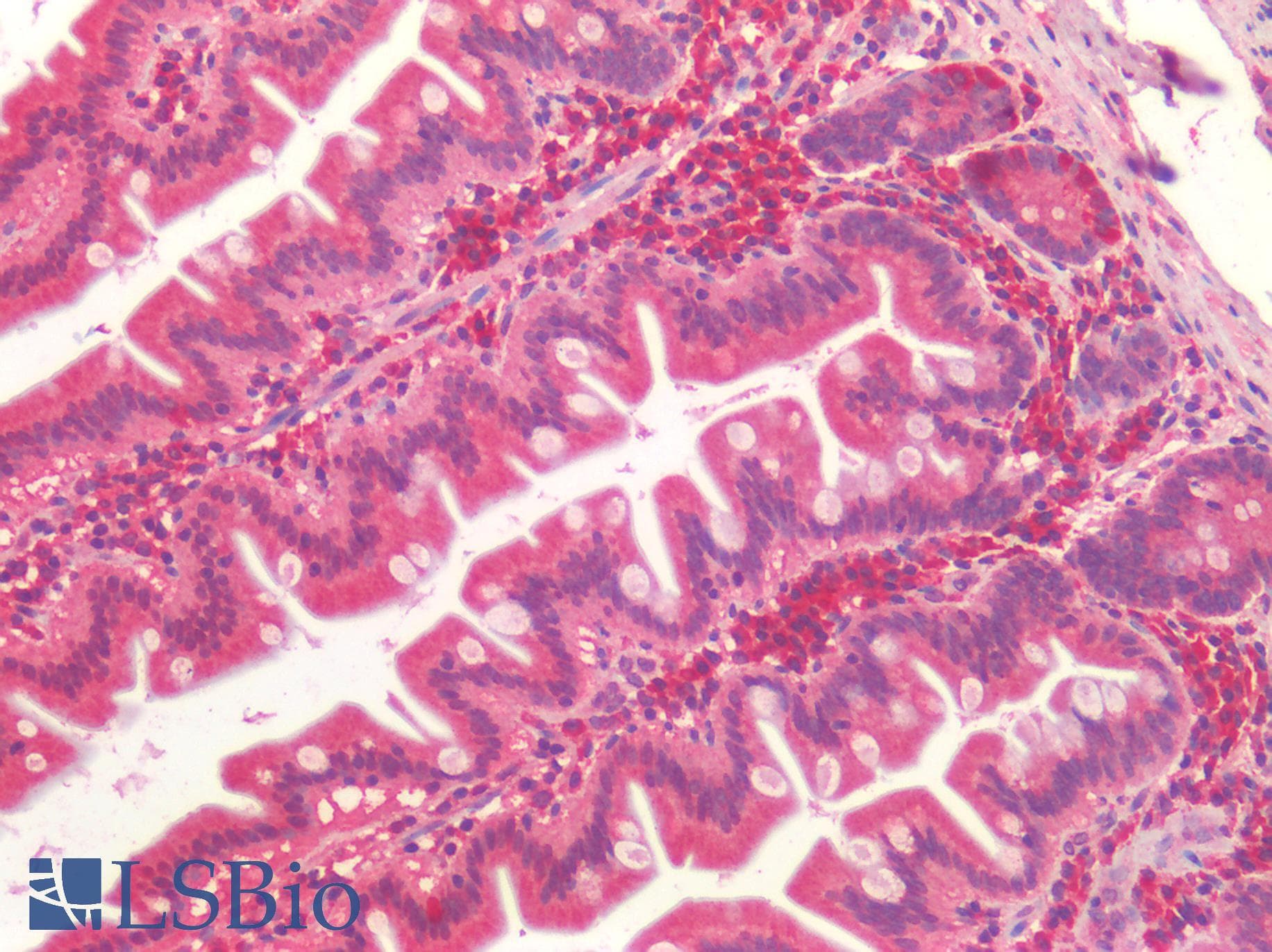 IHC-plus™ Polyclonal Rabbit anti-Human ALK2 / ACVR1 Antibody (IHC)