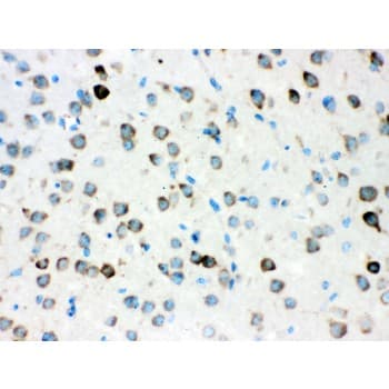 Polyclonal Rabbit anti-Human ATXN2 / SCA2 / Ataxin-2 Antibody (aa1283-1313, IHC, WB)
