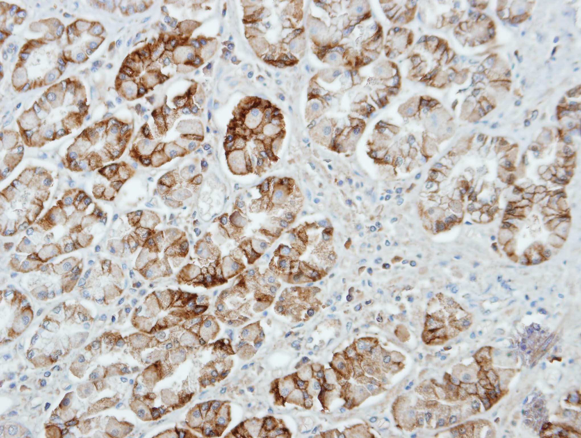 UNC13D Antibody (aa1029-1090)