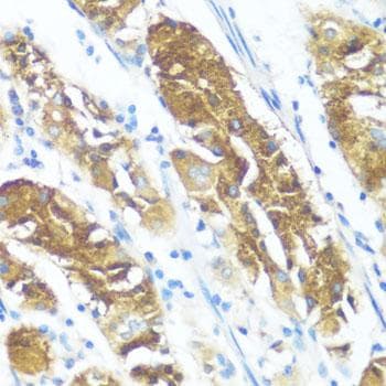 Polyclonal Rabbit anti-Human NME3 Antibody (IHC)