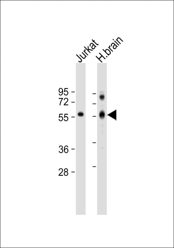 Polyclonal Rabbit anti-Human CORO1A / Coronin 1a Antibody (WB)