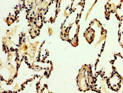 DKK2 Antibody (aa34-259)