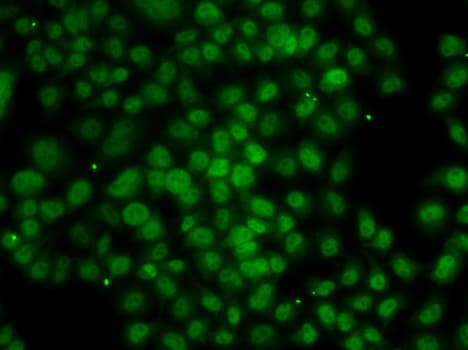 ATMIN Antibody