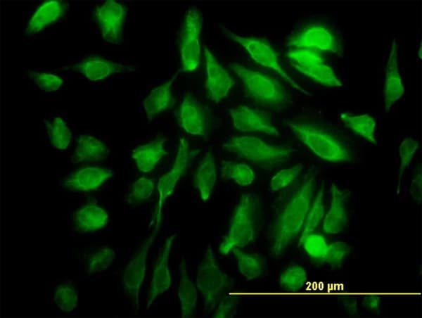 Monoclonal Mouse anti-Human SH3D19 Antibody (clone 5C7, IF, WB)