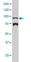 NR3C1/Glucocorticoid Receptor Antibody (clone 2C8)