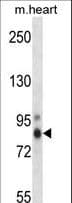 PRKCH / PKC-Eta Antibody (aa314-341)