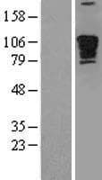 Human PDE4DIP / MMGL Protein (Over-Expression Lysate Myc-DDK (Flag))