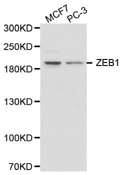ZEB1 / AREB6 Antibody (aa400-750)