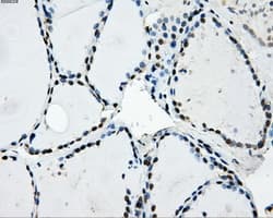 Monoclonal Mouse anti-Human LOX / Lysyl Oxidase Antibody (clone OTI6B11, IHC, IF, WB)