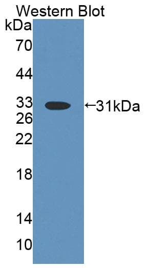 ABCD4 Antibody (HRP)