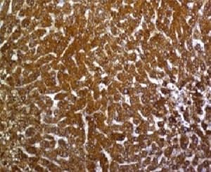 GPC3 / Glypican 3 Antibody (clone SGPN3-1)