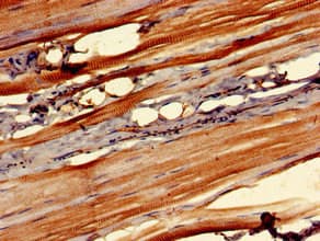 Polyclonal Rabbit anti-Human OSMR / IL-31R-Beta Antibody (IHC, IF)