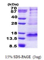 Human BEX1 Protein (Recombinant His)