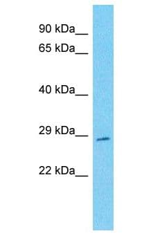TVP23C Antibody (aa76-125)