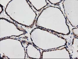 SQSTM1 Antibody (clone OTI4G9)