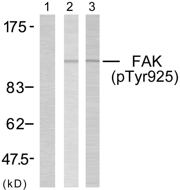 FAK / Focal Adhesion Kinase Antibody (phospho-Tyr925)