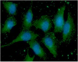 Monoclonal Mouse anti-Human Calgizzarin / S100A11 Antibody (clone AT20D11, WB)