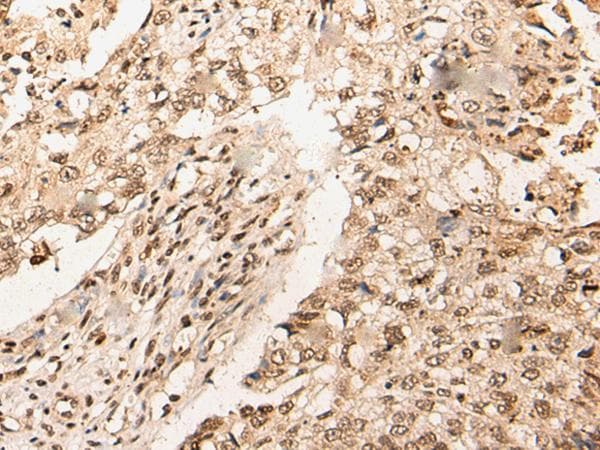URI1 / NNX3 Antibody