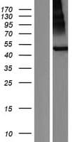 Human RNFT2 / TMEM118 Protein (Over-Expression Lysate Myc-DDK (Flag))