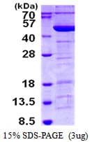 Human TMOD3 / Tropomodulin 3 Protein (Recombinant His)