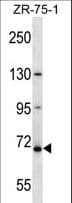 Polyclonal Rabbit anti-Human ZNF135 Antibody (aa176-205, WB)