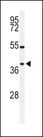 SIRT3 / Sirtuin 3 Antibody (aa250-279)