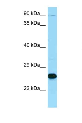 Polyclonal Rabbit anti-Human MME / CD10 Antibody (C-Terminus, WB)