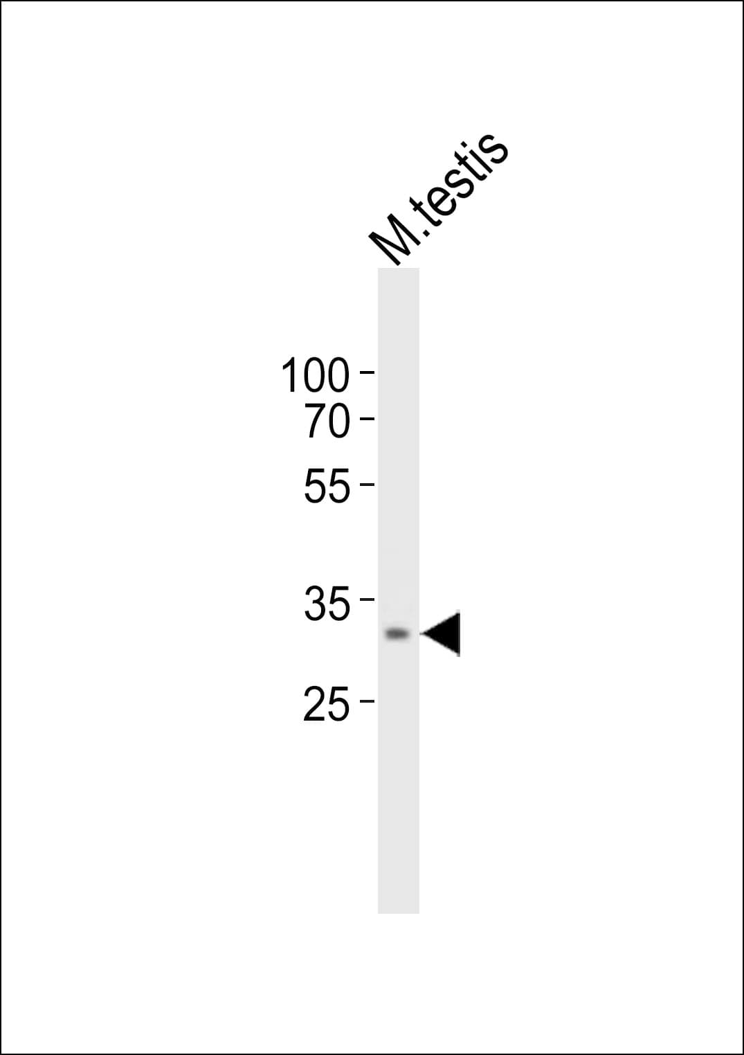 TOMM34 Antibody (aa156-188)