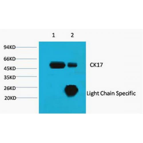 KRT17 / CK17 / Cytokeratin 17 Antibody (clone 10A1)