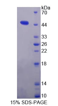Mouse MTTP / MTP Protein (Recombinant His-T7)